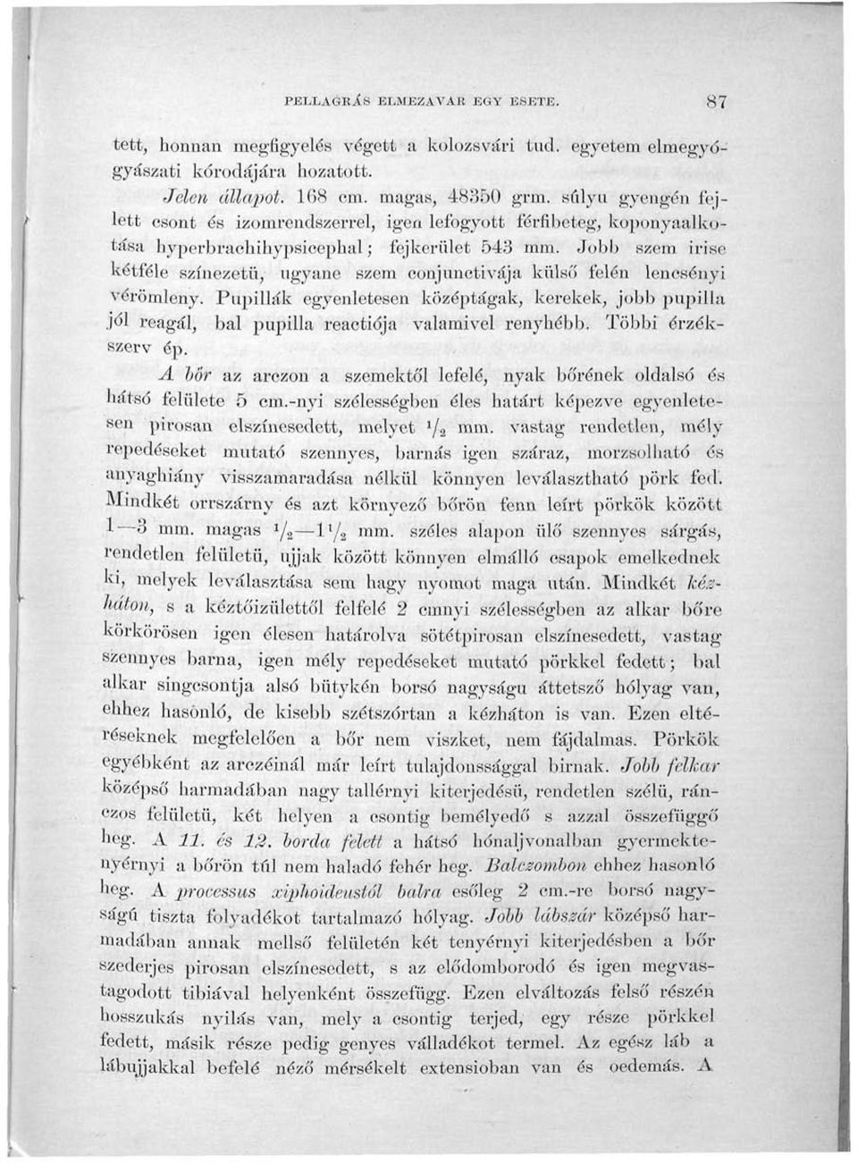 Jobb szem irise kétféle színezetű, ugyané szem conjunctivája külső felén lencsényi vérömleny.