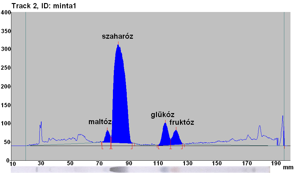 19.ábra. Referencia elválasztás denzitogramja (ST3, 17. ábra) 20.