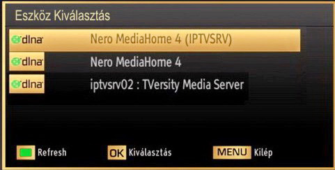 Az eljárással kapcsolatos további információkért olvassa el a Vezetékes csatlakoztatás címû fejezetet. Ha a Net TV nem működik először ellenőrizze a modemet (routert).