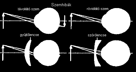 Látás, az emberi szem: http://www.mozaik.info.