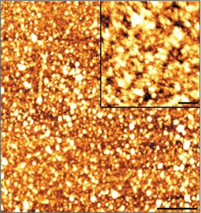 Az immunkomplexek méretének meghatározása Size determination of immune complexes I.