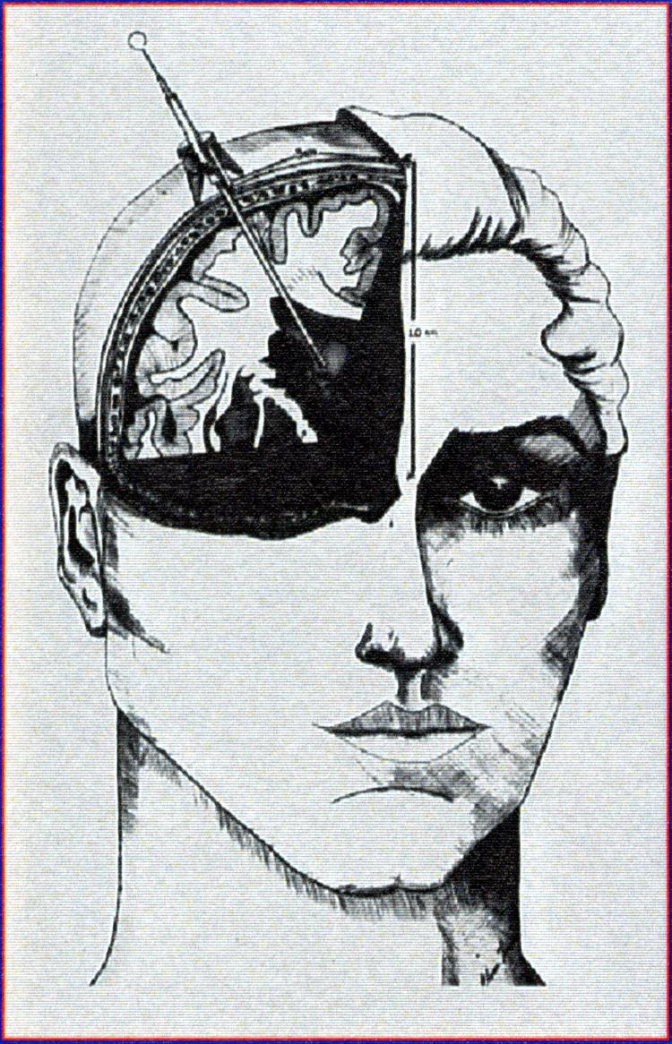 Intracranialis nyomás