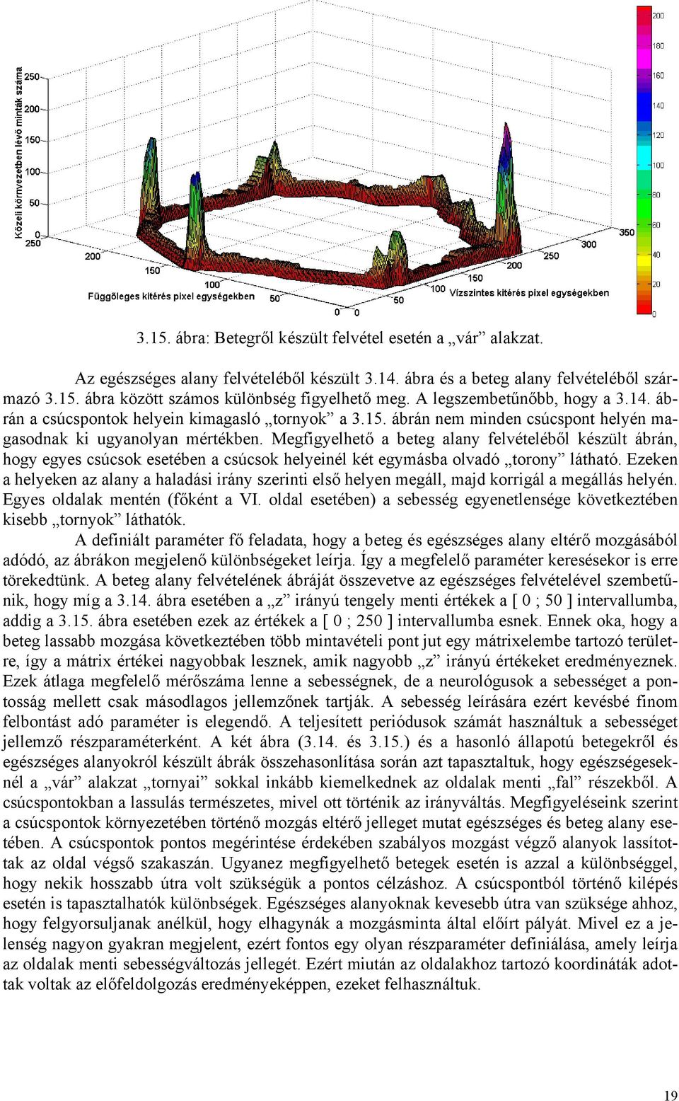 Megfigyelhető a beteg alany felvételéből készült ábrán, hogy egyes csúcsok esetében a csúcsok helyeinél két egymásba olvadó torony látható.