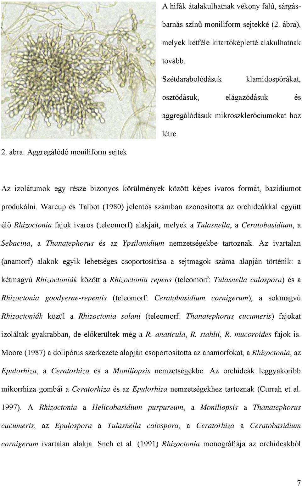 ábra: Aggregálódó moniliform sejtek Az izolátumok egy része bizonyos körülmények között képes ivaros formát, bazídiumot produkálni.