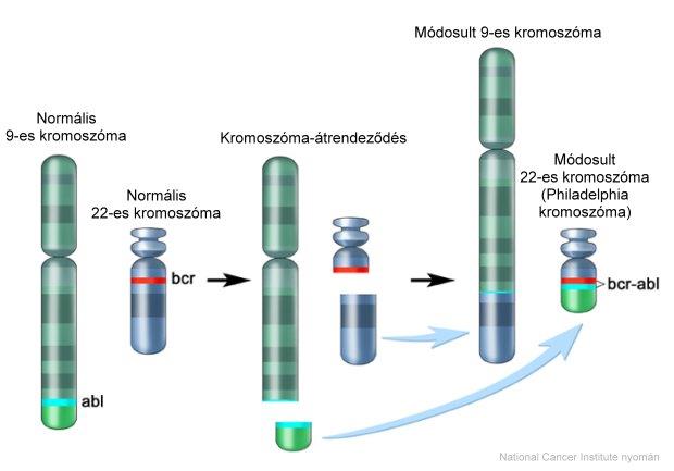 Philadelphia kromoszóma kialakulása - a kromoszóma-átrendeződés a 9-es és a 22-es kromoszóma között megy végbe.
