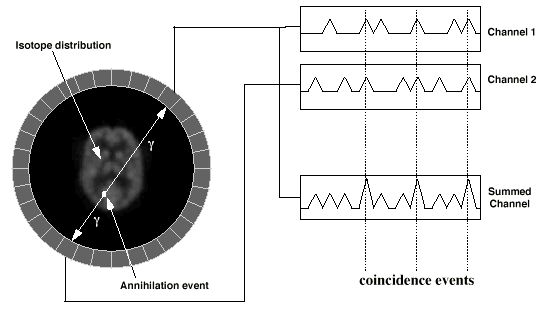 Pozitron emissziós tomográfia rekonstrukciója Line of Response : ugyanazon bomló izotóp által kibocsátott γ fotonok beütési helyét összekötő szakasz Érdemes szem előtt tartani, hogy