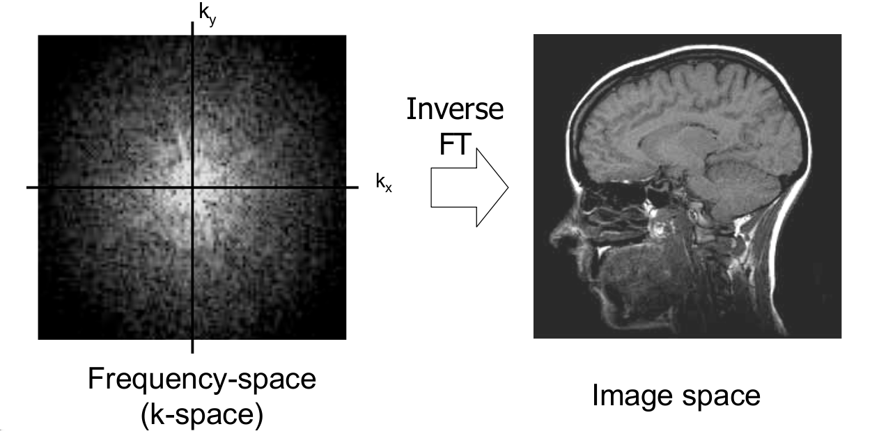 Rekonstrukció MRI elméleti háttér Matematikai háttérismeretanyag Bevezetés Slice encoding: Szelet választás Position encoding: Pozició választás Képrekonstrukció