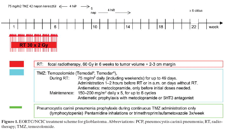 Glioblastoma multiforme