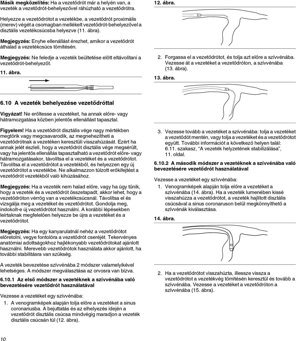 Megjegyzés: Enyhe ellenállást érezhet, amikor a vezetődrót áthalad a vezetékcsúcs tömítésén. Megjegyzés: Ne feledje a vezeték beültetése előtt eltávolítani a vezetődrót-behelyezőt. 11. ábra. 2.