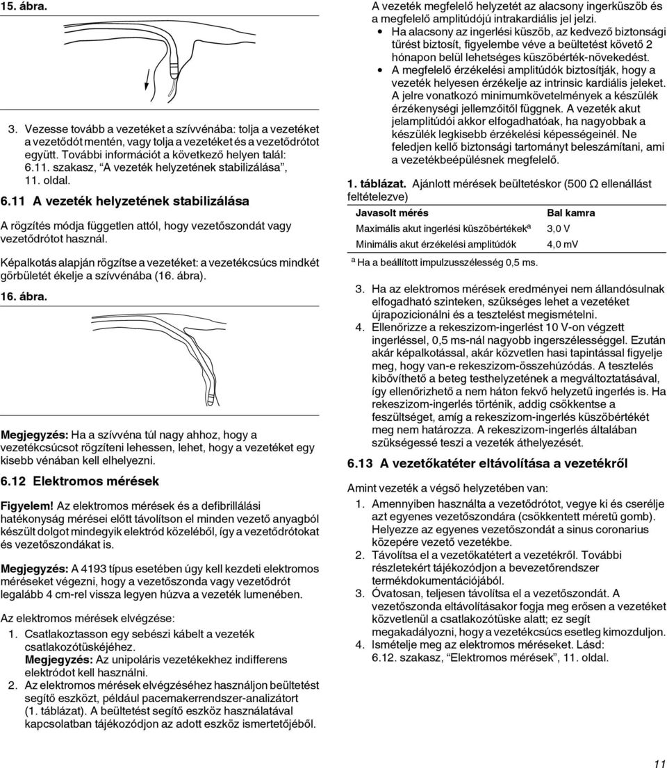 Képalkotás alapján rögzítse a vezetéket: a vezetékcsúcs mindkét görbületét ékelje a szívvénába (16. ábra)