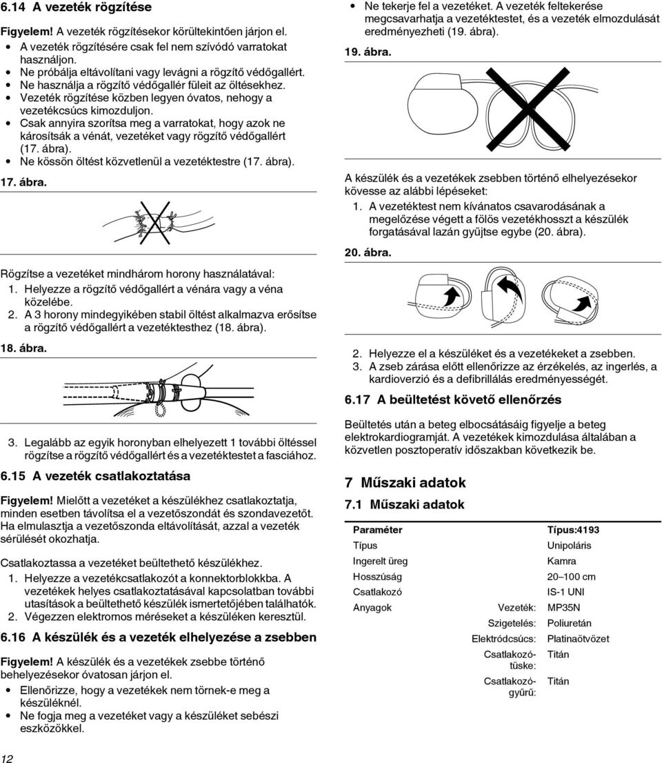 Csak annyira szorítsa meg a varratokat, hogy azok ne károsítsák a vénát, vezetéket vagy rögzítő védőgallért (17. ábra). Ne kössön öltést közvetlenül a vezetéktestre (17. ábra). 17. ábra. Rögzítse a vezetéket mindhárom horony használatával: 1.
