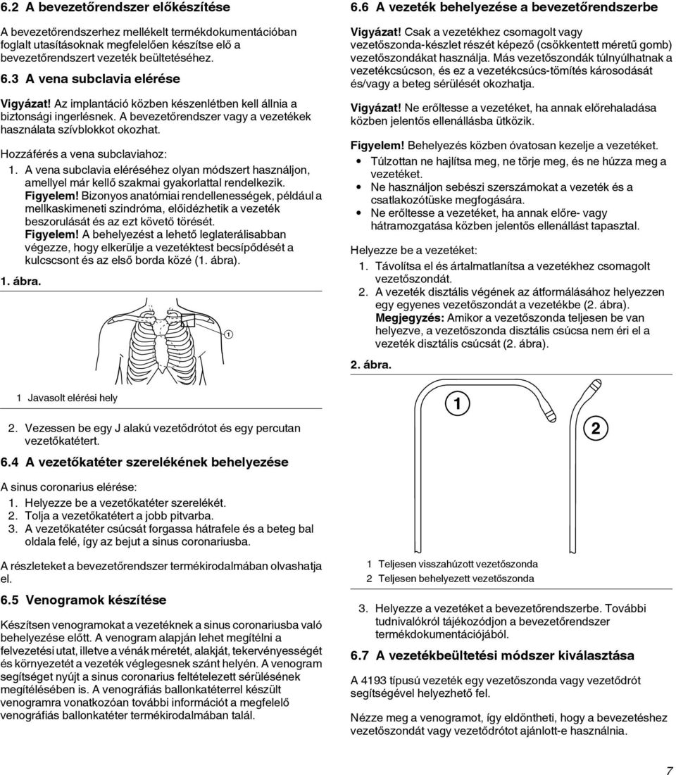 Hozzáférés a vena subclaviahoz: 1. A vena subclavia eléréséhez olyan módszert használjon, amellyel már kellő szakmai gyakorlattal rendelkezik. Figyelem!