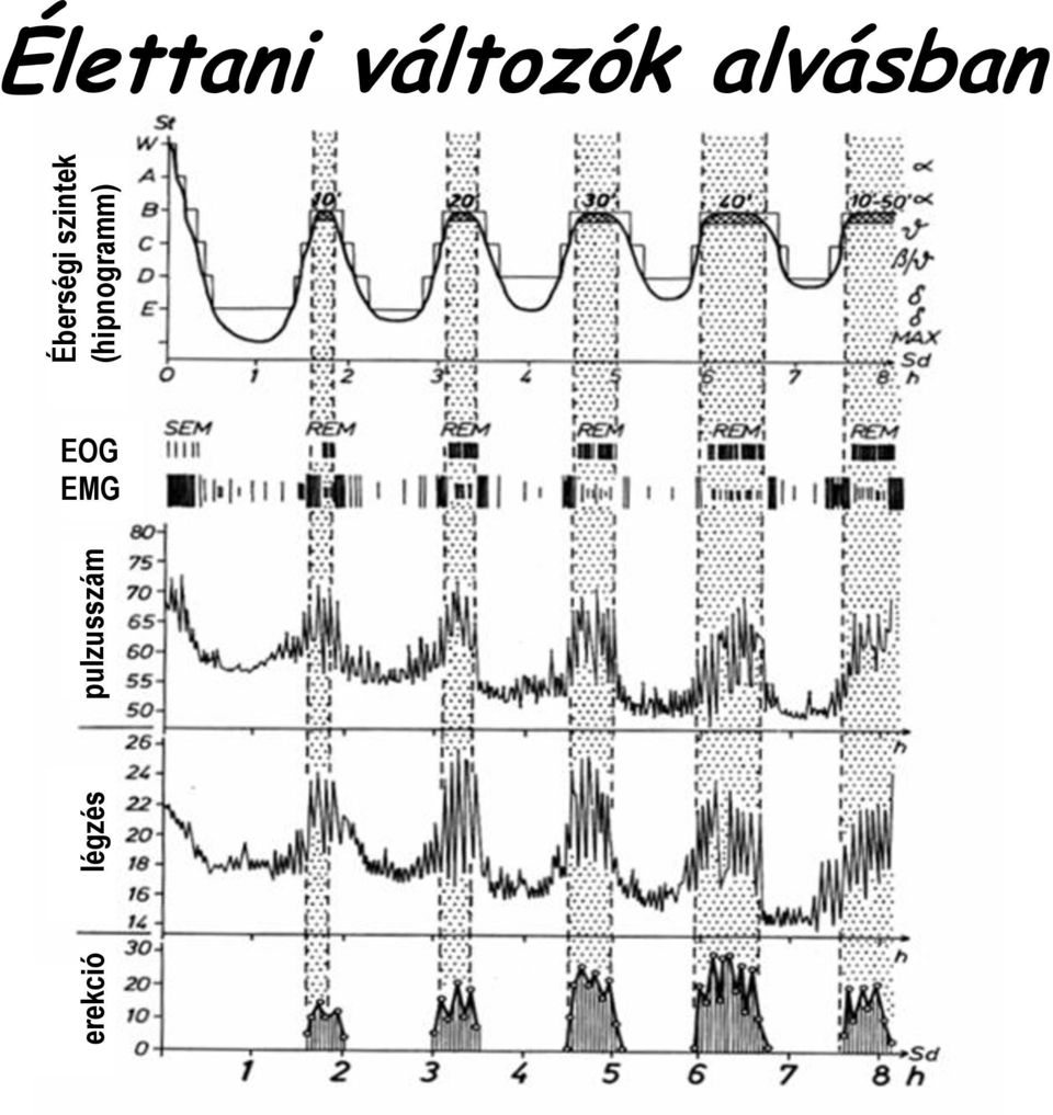 szintek (hipnogramm)