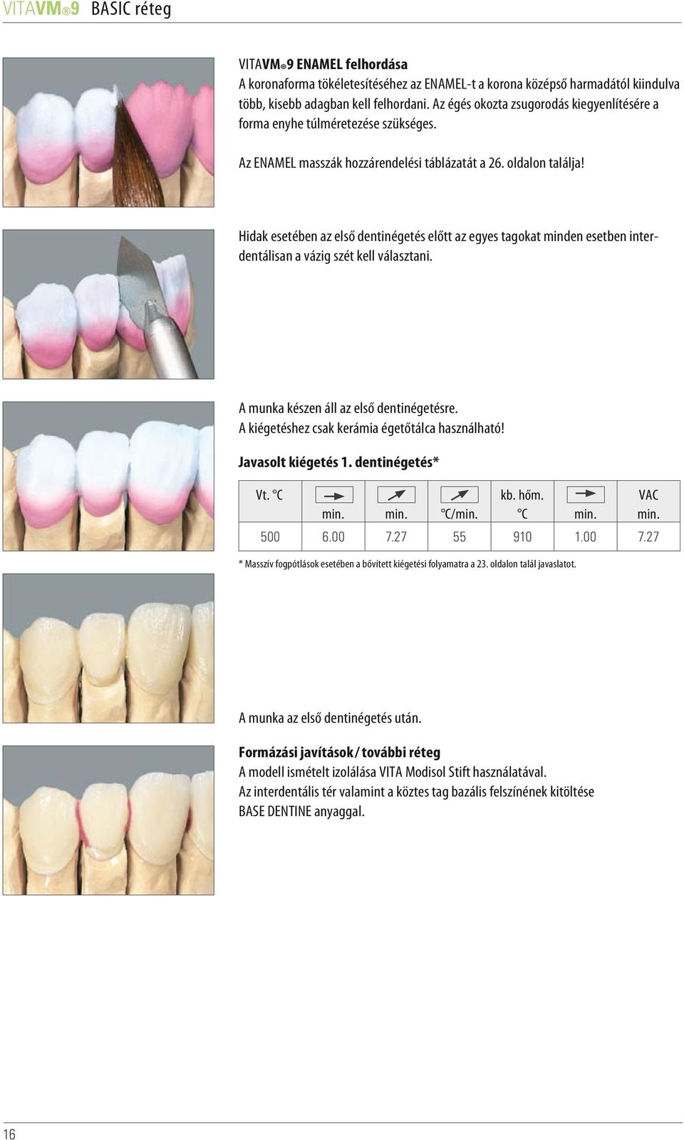 Hidak esetében az első dentinégetés előtt az egyes tagokat minden esetben interdentálisan a vázig szét kell választani. A munka készen áll az első dentinégetésre.