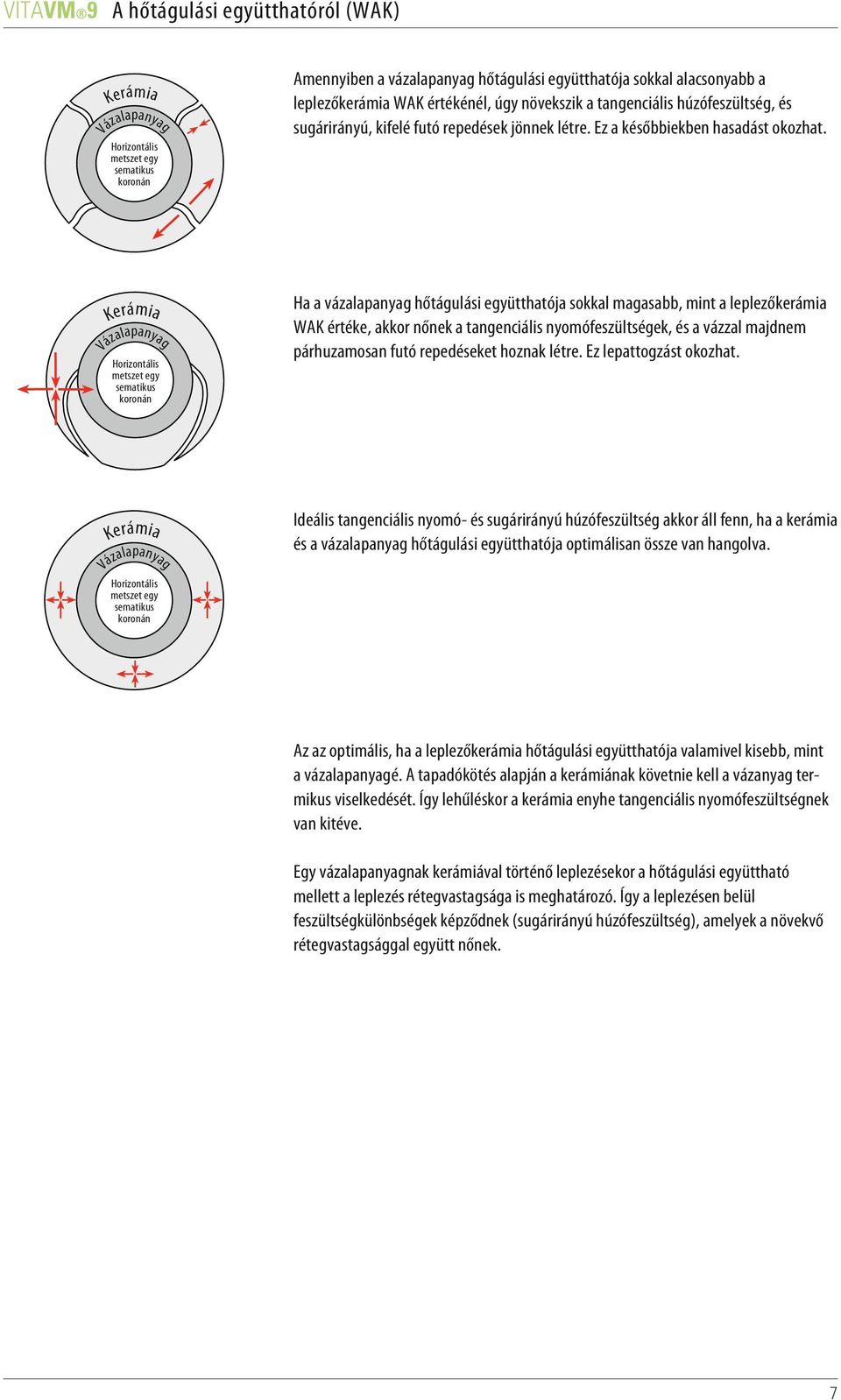 Kerámia Vázalapanyag Horizontális metszet egy sematikus koronán Ha a vázalapanyag hőtágulási együtthatója sokkal magasabb, mint a leplezőkerámia WAK értéke, akkor nőnek a tangenciális