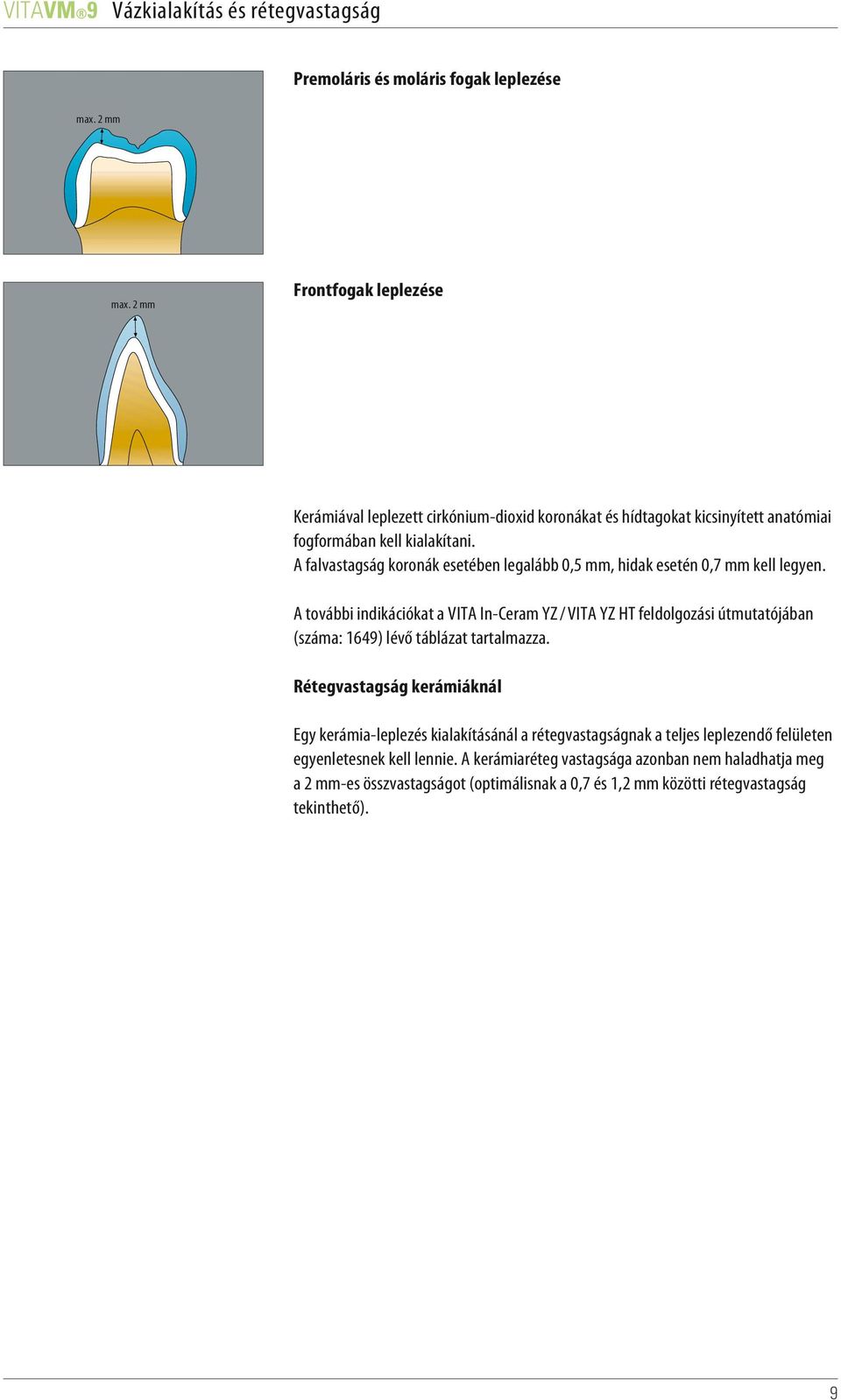 A falvastagság koronák esetében legalább 0,5 mm, hidak esetén 0,7 mm kell legyen.