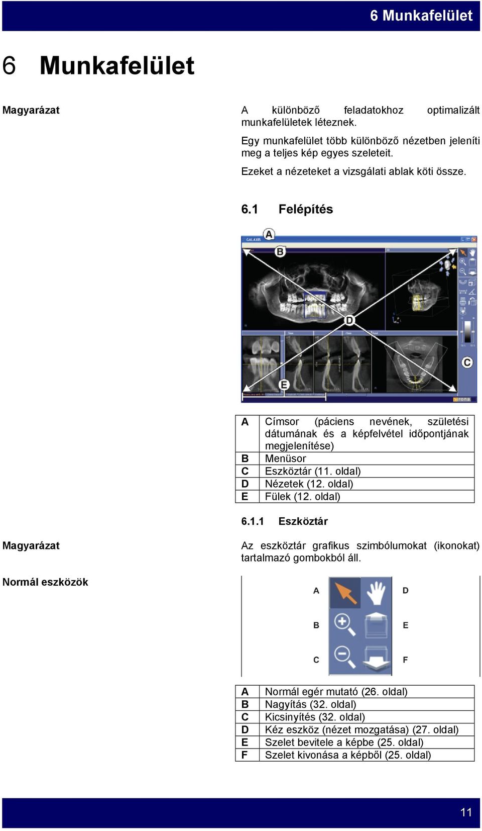 1 Felépítés A Címsor (páciens nevének, születési dátumának és a képfelvétel időpontjának megjelenítése) B Menüsor C Eszköztár (11. oldal) D Nézetek (12. oldal) E Fülek (12.