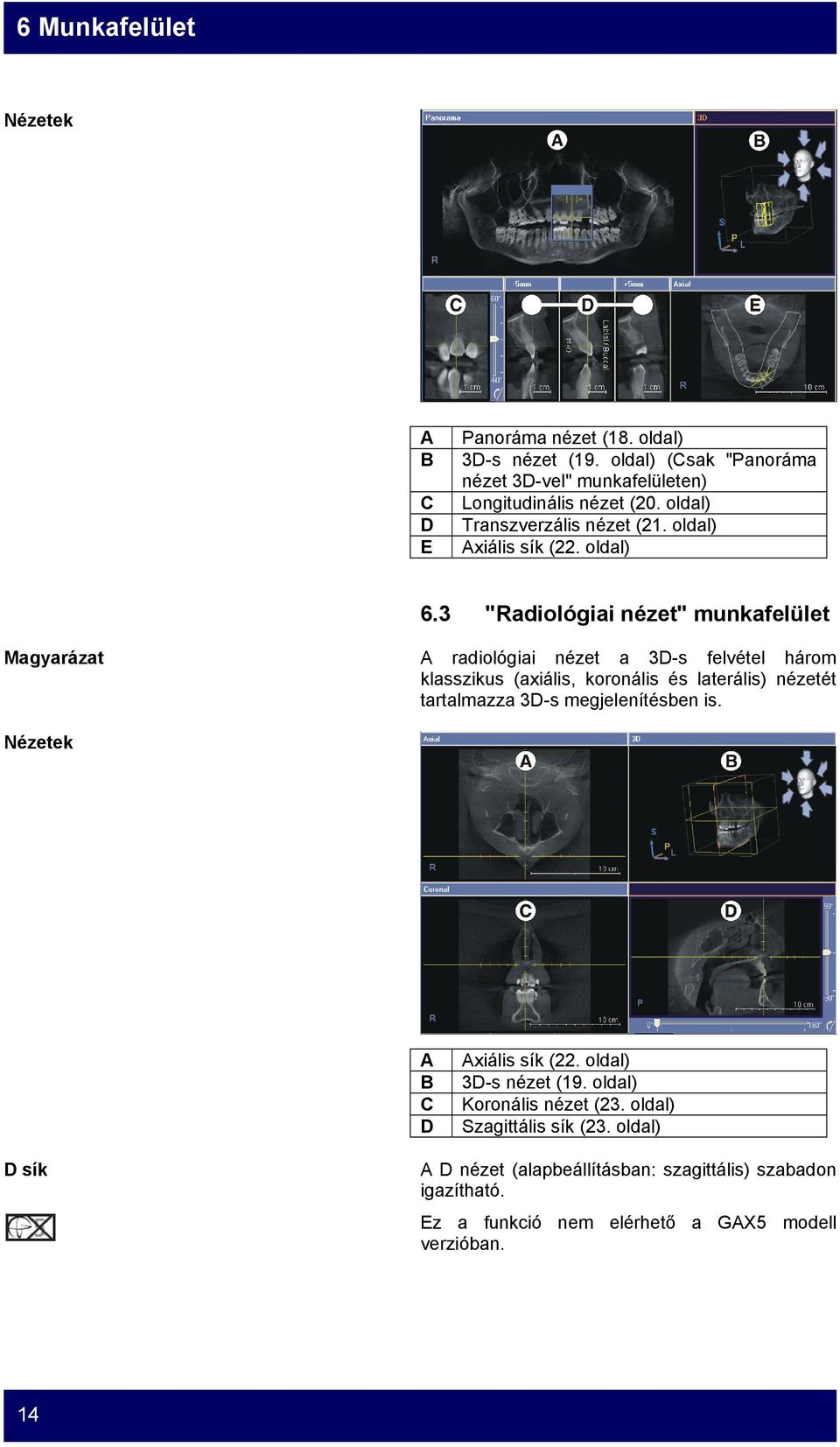 3 "Radiológiai nézet" munkafelület A radiológiai nézet a 3D-s felvétel három klasszikus (axiális, koronális és laterális) nézetét tartalmazza 3D-s