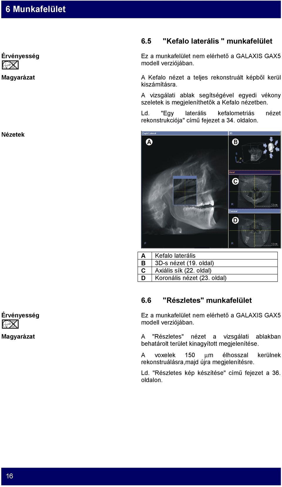 Nézetek A B C D Kefalo laterális 3D-s nézet (19. oldal) Axiális sík (22. oldal) Koronális nézet (23. oldal) 6.