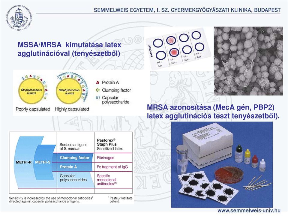 MRSA azonosítása (MecA gén,
