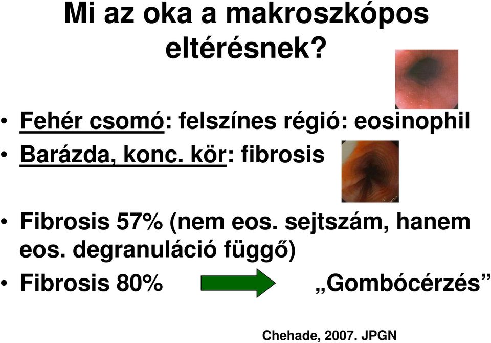 konc. kör: fibrosis Fibrosis 57% (nem eos.