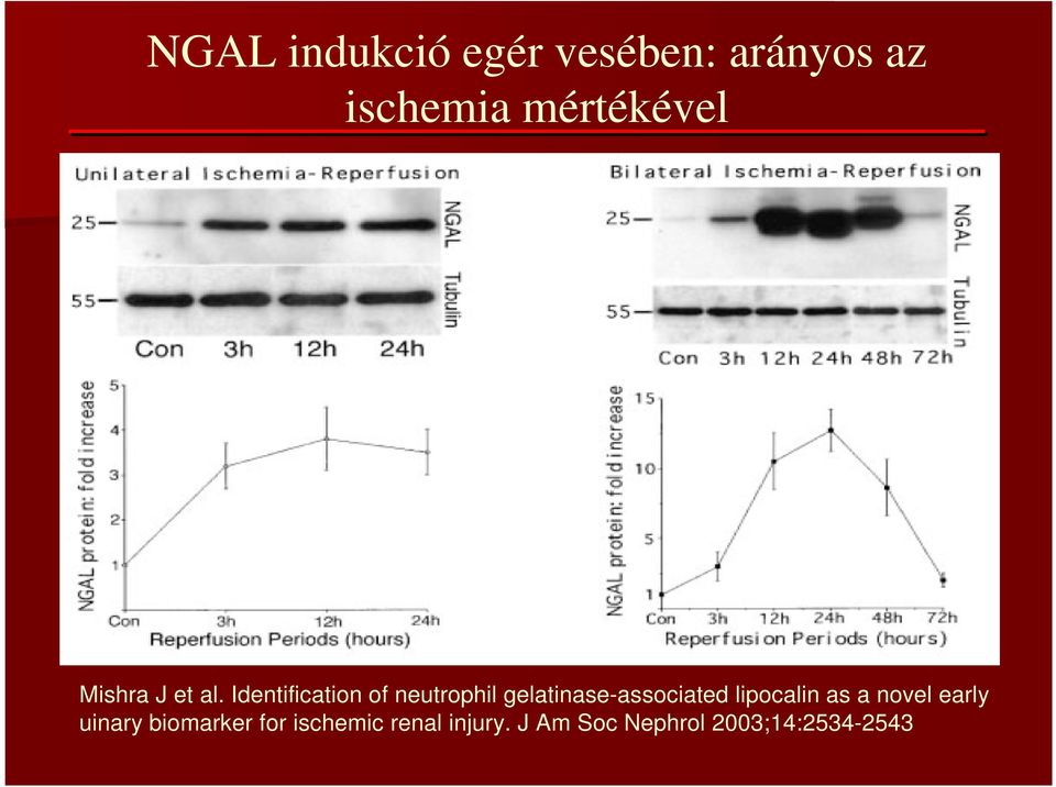 Identification of neutrophil gelatinase-associated