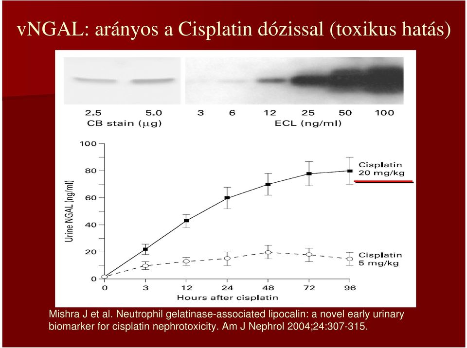 Neutrophil gelatinase-associated lipocalin: a