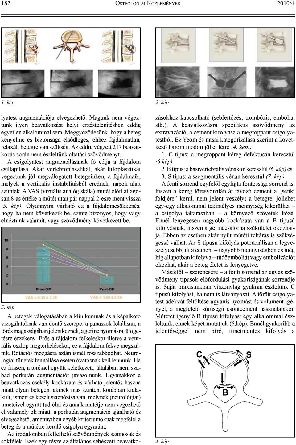 A csigolyatest augmentálásának fő célja a fájdalom csillapítása.