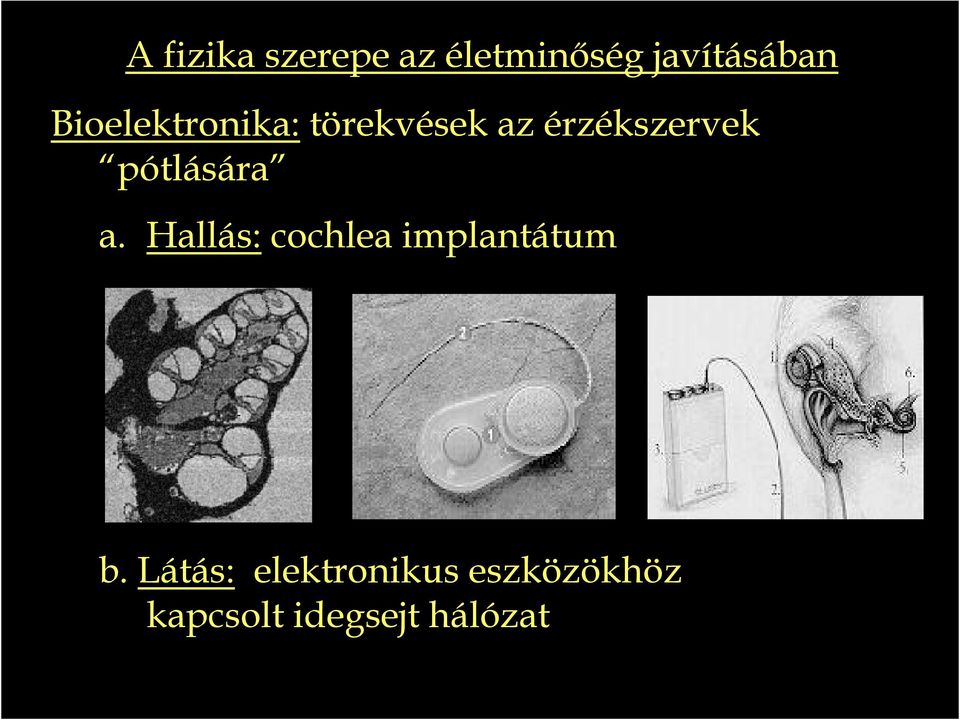 pótlására a. Hallás: cochlea implantátum b.