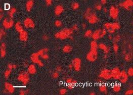 anyagok szintéziséhez vezetnek: antimikrobiális peptidek (such as cathelicidin-related antimicrobial peptide (CRAMP)), cytokines (such as tumour necrosis factor (TNF) and interleukin-1β (IL-1β)),