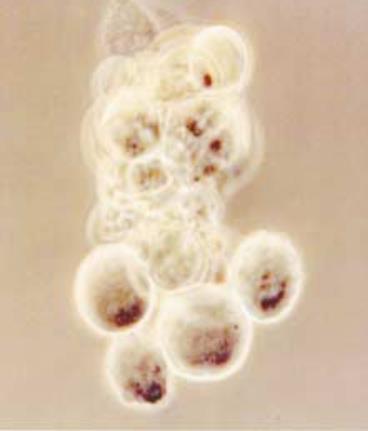 HIPOTÉZIS A PROGRAMOZOTT SEJTHALÁL (APOPTOSIS) ÉS A NECROSIS KORAI KÖVETKEZMÉNYEIT ÉSZLELJÜK AZ ÉLETKÉPTELEN EMBRIÓK TENYÉSZTŐ FOLYADÉKÁBAN Az alacsonyabb életképességű embriókban magasabb az