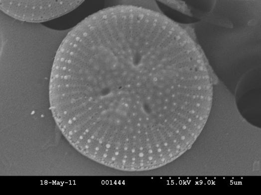 Cyclotella ocellata Változatos morfológia