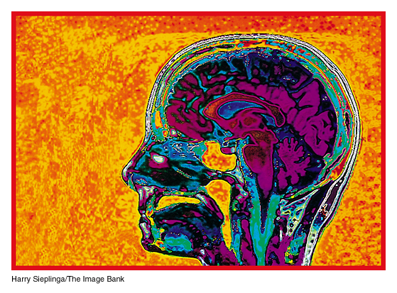 Magnetic Resonance Imaging (MRI) a gyógyászatban elÿnyök: - nem használ ionizáló sugárzást mint a röntgen - nem kell feszték vagy kontrasztanyagot bevinni - lágy-szövetek kontrasztosabbak