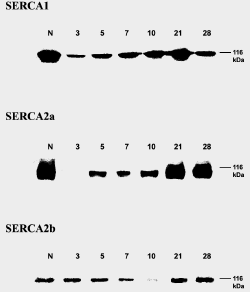 46 21. Ábra: A SERCA proteinek szintje a soleus izom regenerációja során. Az inszert reprezentatív immunoblottokat mutat. A: SERCA1; B: SERCA2a; C: SERCA2b; N normál izom, 1-28 a regeneráció napja.