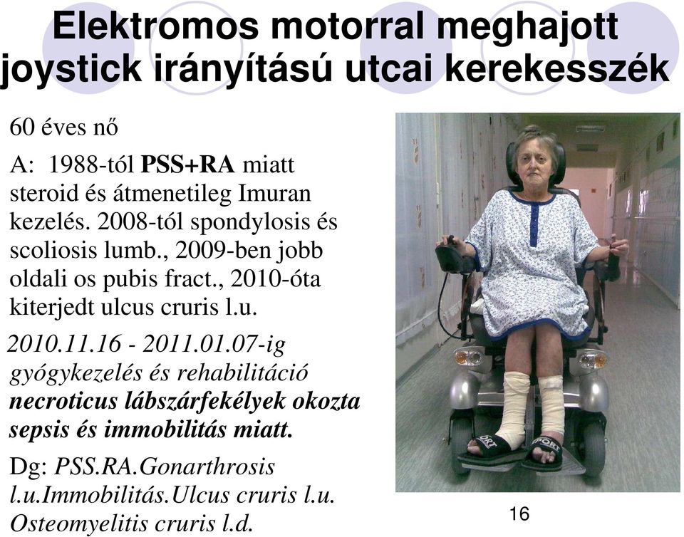 , 2010-óta kiterjedt ulcus cruris l.u. 2010.11.16-2011.01.07-ig gyógykezelés és rehabilitáció necroticus lábszárfekélyek okozta sepsis és immobilitás miatt.