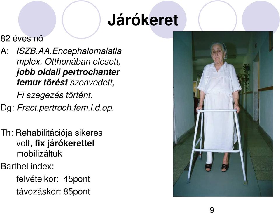 szegezés történt. Dg: Fract.pertroch.fem.l.d.op.