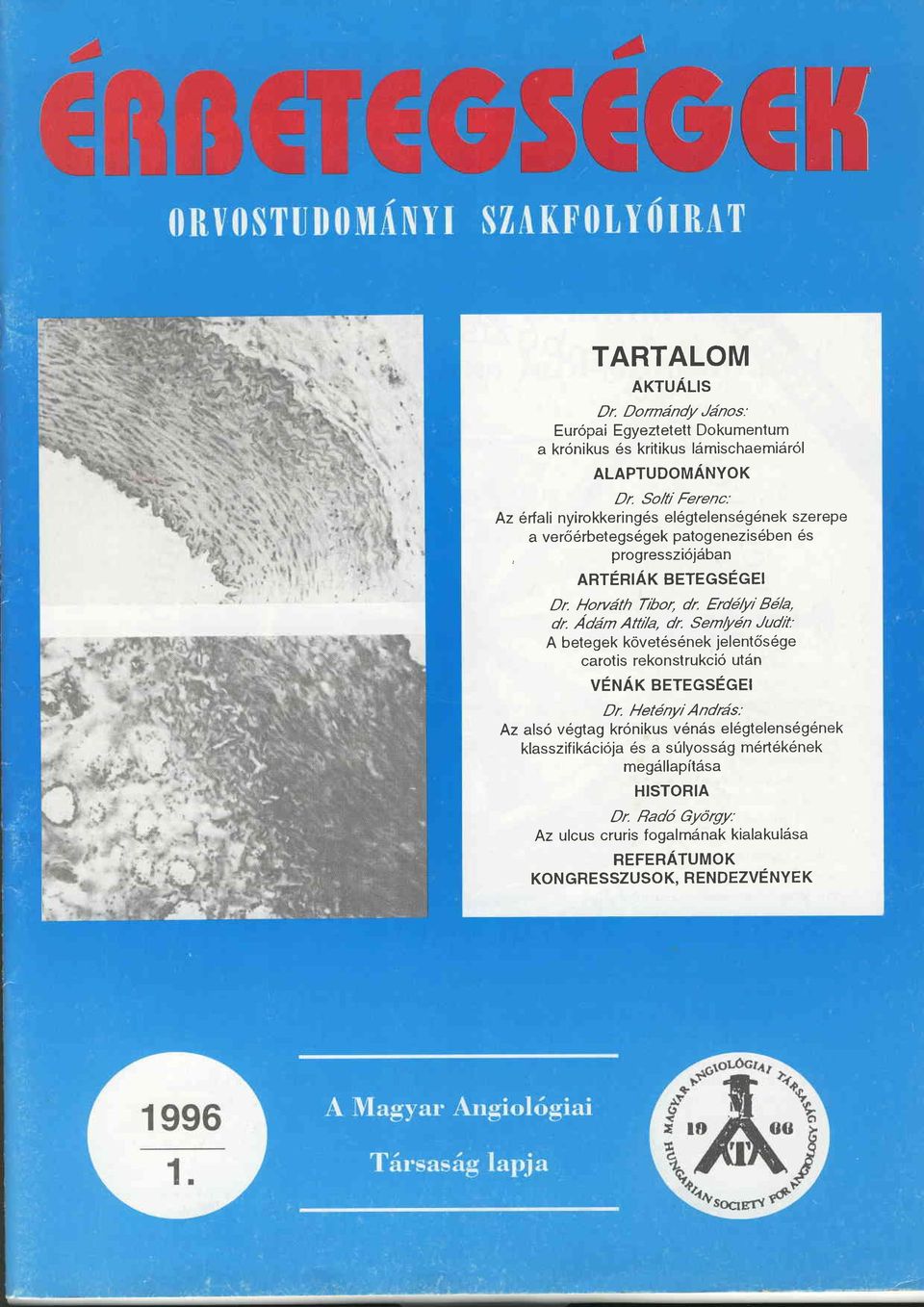 Erdälyr Bä/a, dr. Ädäm Attt/a, dr. Semfön Judrt: A betegek követ6s6nek jelentös6ge carotis rekonstrukcid utän VENÄT BETEGSEGEI Dr.