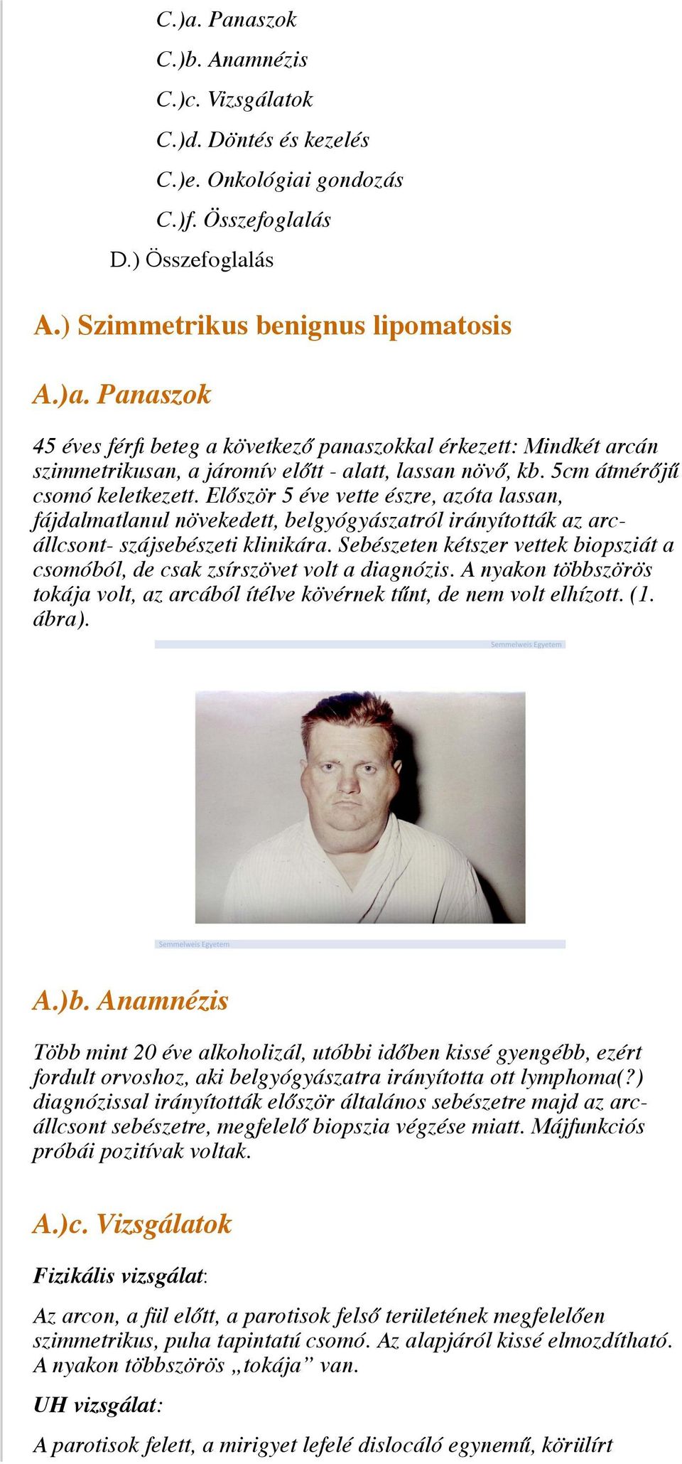 Sebészeten kétszer vettek biopsziát a csomóból, de csak zsírszövet volt a diagnózis. A nyakon többszörös tokája volt, az arcából ítélve kövérnek tűnt, de nem volt elhízott. (1. ábra). A.)b.