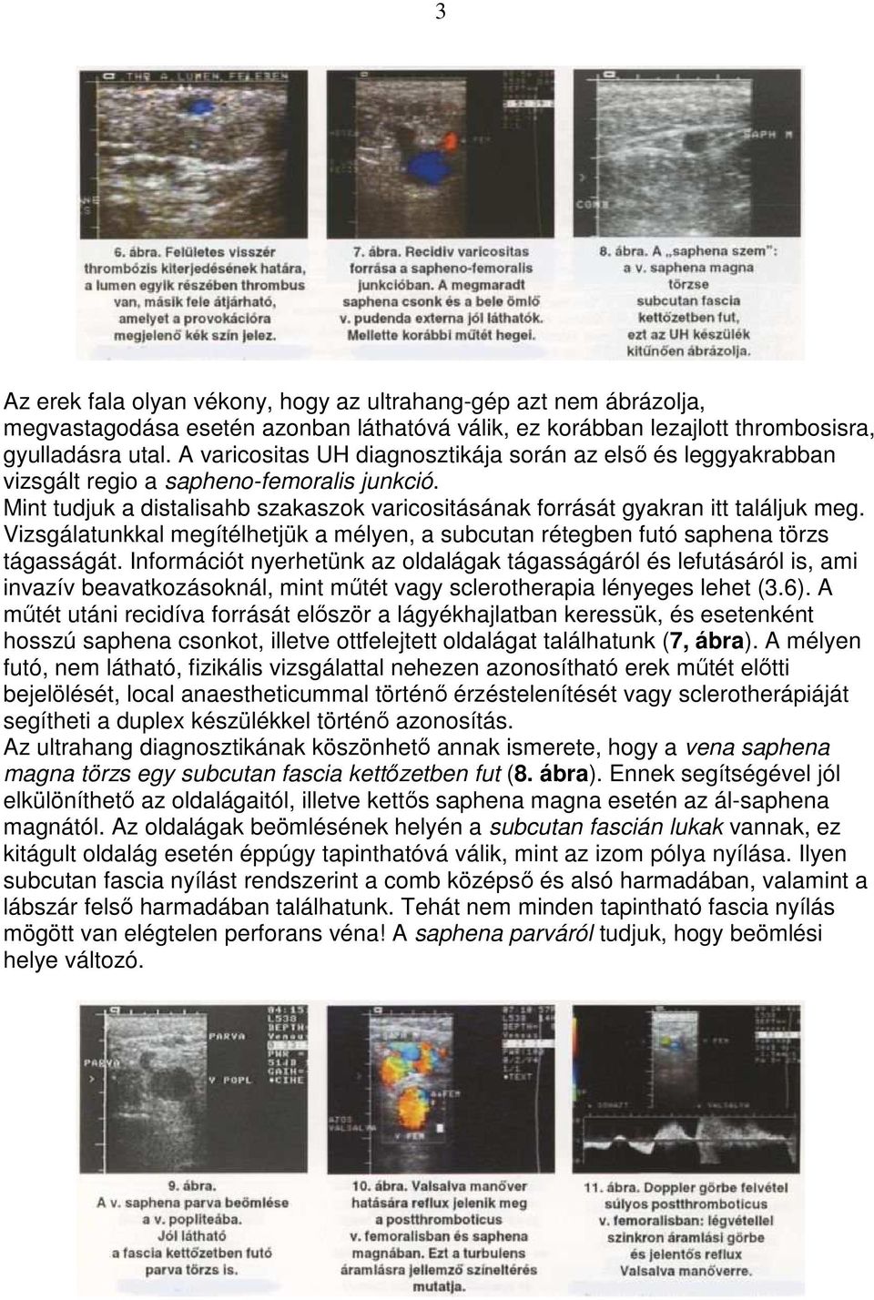 Vizsgálatunkkal megítélhetjük a mélyen, a subcutan rétegben futó saphena törzs tágasságát.