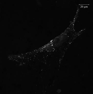 nem permeabilizált α-hspxdn permeabilizált A vad típusú és monomer PXDN konstrukt eltérő lokalizációját más rendszerben is meg kívántuk erősíteni, ezért azokat PXDN-hiányos egérből származó primer