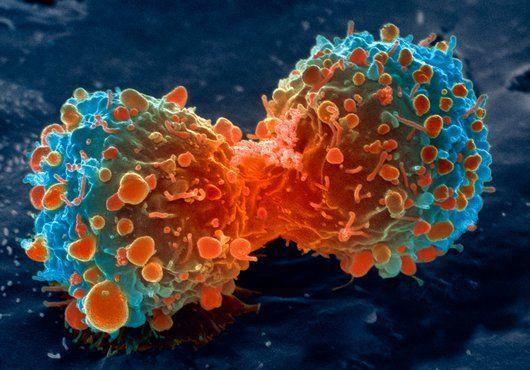 A tumoros sejt elfelejt elpusztulni Forrás: www.nih.