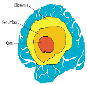 Semmelweis Egyetem Radiológiai és Onkoterápiás Klinika Gyakorlati Neuroradiológia A stroke képalkotó diagnosztikája. Vascularis myelopathia. Vascularis malformatiók Dr.