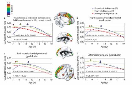 A cortex gyermek- és serdülőkori fejlődése és az IQ Shaw P etal., Nature, 2006, 44, 676.