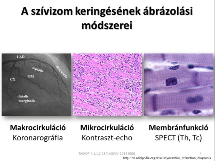 Ez egy invazív beavatkozás, melynek során a koszorúerekbe röntgen kontrasztanyagot fecskendezve fluoroszkóppal tehetjük láthatóvá az ereket, azok lefutását és szűkületeit.