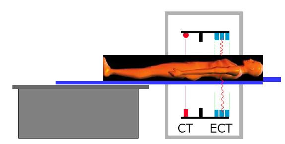 25 26 Lehetséges transzmissziós képek Utólagos illesztés: Gamma-forrás áteresztési képe röntgen (~30-140 kvp) Eltérő pozicionálás miatt a merevtest-transzformáció pontatlan magas zajszint 15-30