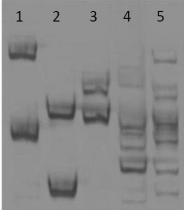 1 2 3 4 5 17. ábra: Univerzális primerpárral végrehajtott PCR-SSCP vizsgálat eredménye. Alkalmazott eletroforetikus paraméterek: +20 C, 400V, 8h.. Az R-F1 univerzális primerpár PCR-SSCP mintázata az 1.