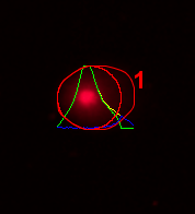 31. ábra. Egy kompakt csóva ImageJ 1.47 OpenComet szoftverrel detektált képe frissen fejt tejminta esetében.