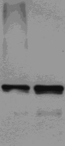 1 2 250 kda 130 kda 95 kda 72 kda 55 kda plazma + LPO + H 2 O 2 plazma + LPO 35. ábra: Laktoperoxidáz detektálása humán plazma mintákban Western blot módszerrel.