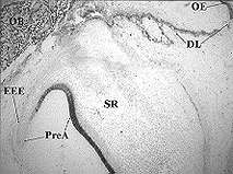 A 17 hetes foetus orális epitheliumának, illetve foglécének CD44 expressziója Az orális epithelium (OE) bazális sejtsora, valamint az ebb l kiinduló fogléc (DL) osztódó sejtjei intenzív CD44 reakciót