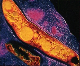 2. IRODALMI ÁTTEKINTÉS 2.1. A Mycobacterium tuberculosis kórokozó baktérium A M. tuberculosis egy lassan szaporodó, intracelluláris, obligát aerob baktérium (3. ábra).